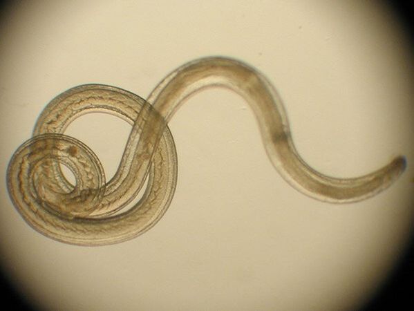 Trichinella ca specie de parazit uman