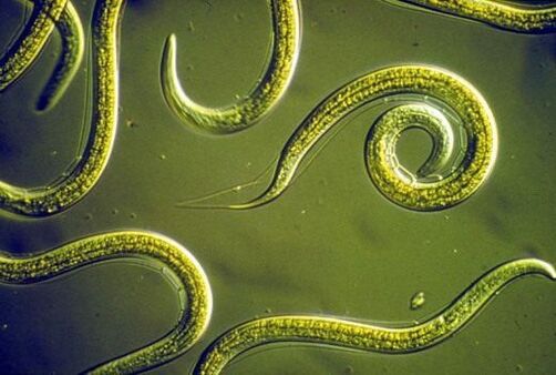 Viermi nematozi paraziți care trăiesc în intestinul subțire uman