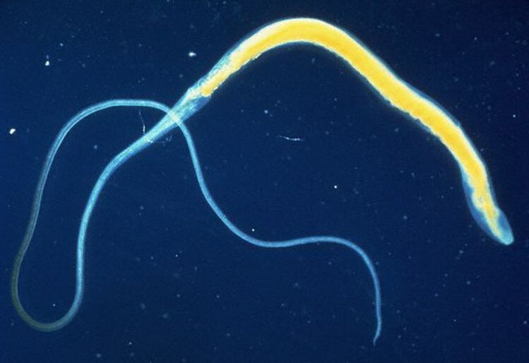 Virmele este un parazit intestinal comun.