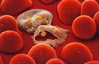 plasmodiu de malarie în corpul uman