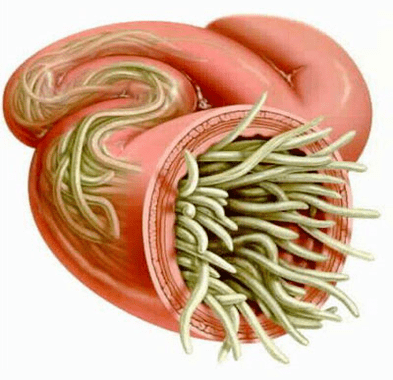 viermi rotunzi în intestinul uman